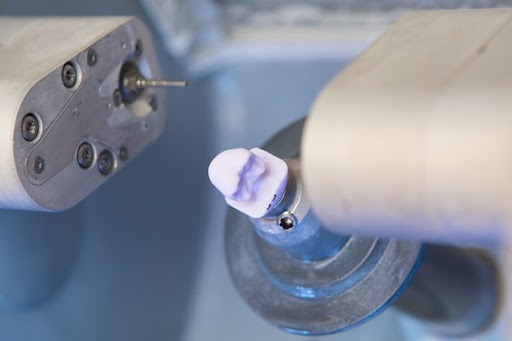 Benefits Of CEREC® Crowns