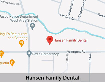 Map image for Dental Implants in Pasco, WA